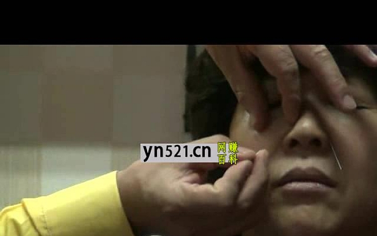 刘吉领 新一针疗法 颈肩腰腿痛临床应用部分视频